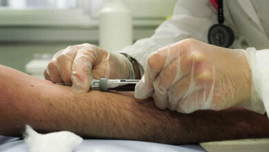 Gamma GT Alta: Descubre los Valores Normales y las Causas Comunes del Aumento en 2026 Gamma GT Alta: Descubre los Valores Normales y las Causas Comunes del Aumento en 2026