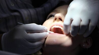 ¿Eres Candidato Ideal para Carillas Dentales? Descubre Todo lo que Necesitas Saber para Transformar tu Sonrisa